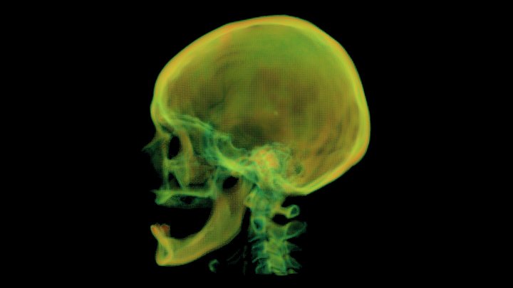 VHF Skull Point Cloud 3D Model